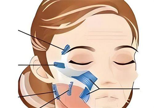 北京歆悦医疗美容医院详细的预约挂号方式及流程