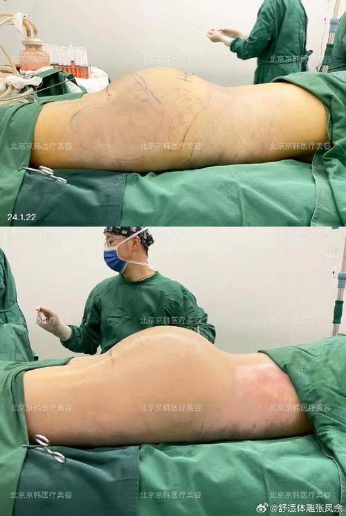 北京京民整形医院是正规医院吗？