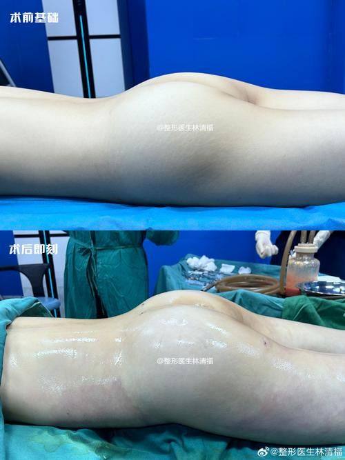 北京京民整形医院详细的预约挂号方式及流程