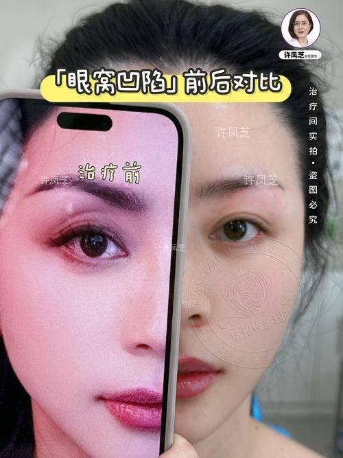 北京歆悦医疗美容医院收费价格表/收费标准