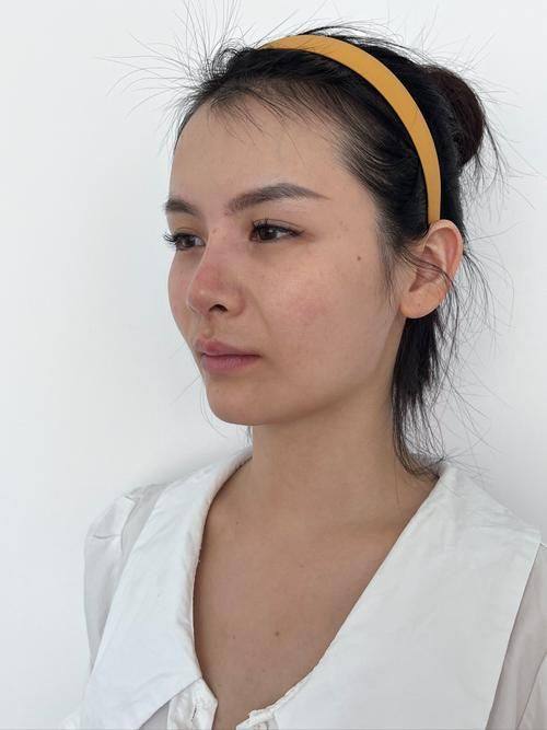 广州驻妍光医疗美容诊所收费价格表/收费标准