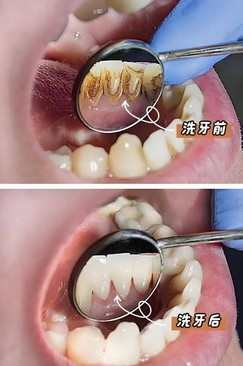 甘肃兰州萌芽口腔特色项目及技术优势