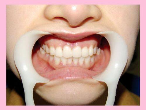 甘肃兰州萌芽口腔真人口碑评价怎么样？