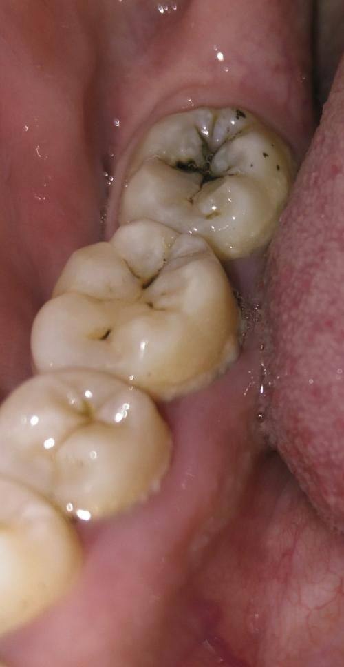 广东深圳陈青华口腔特色项目及技术优势