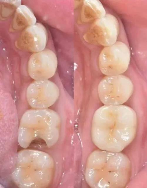 武汉清华阳光口腔门诊部有限公司鲁巷分公司特色项目及技术优势