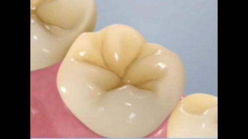 南宁牙之道口腔连锁收费价格表/收费标准