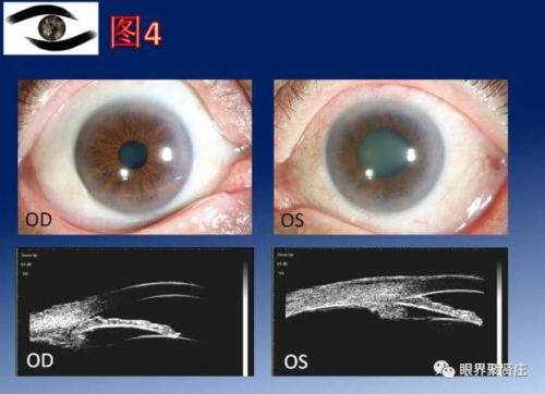 淮安市中医院眼科是正规医院吗？