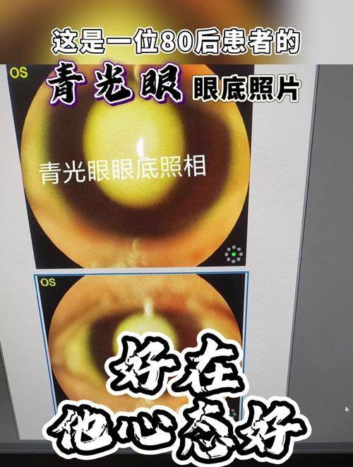 淮安市中医院眼科真人口碑评价怎么样？