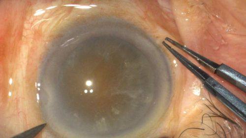 淮安市中医院眼科详细的预约挂号方式及流程