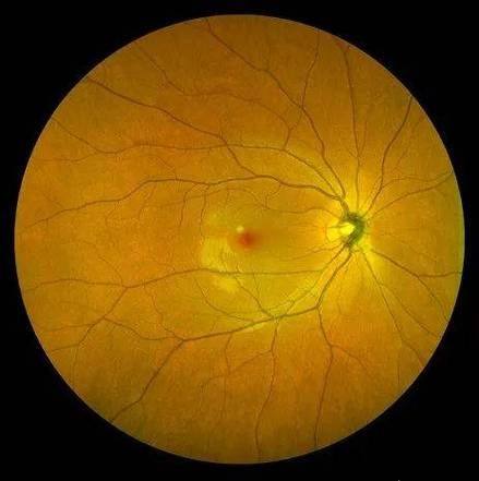 赣州市人民医院眼科真人口碑评价怎么样？