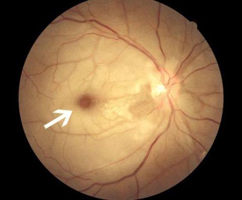 印江自治县人民医院真人口碑评价怎么样？