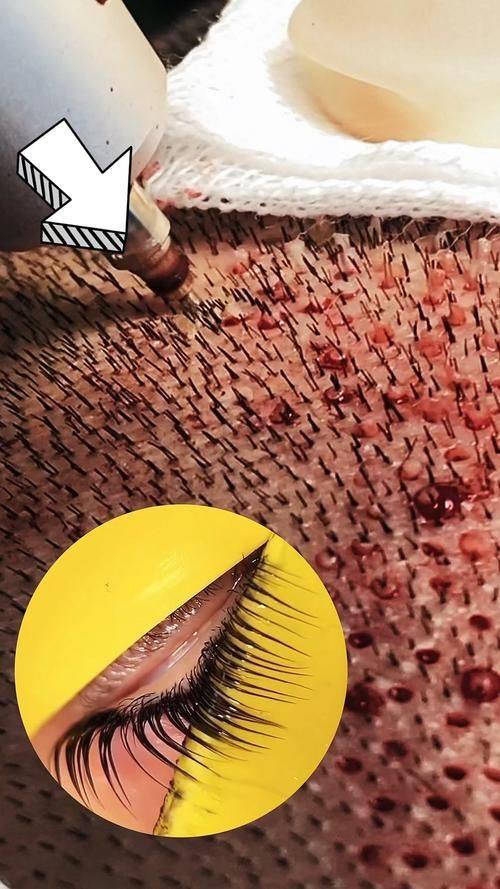 青岛青医附院医学美容整形医院特色项目及技术优势