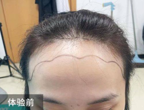 沈阳伊美尔医疗美容详细的预约挂号方式及流程