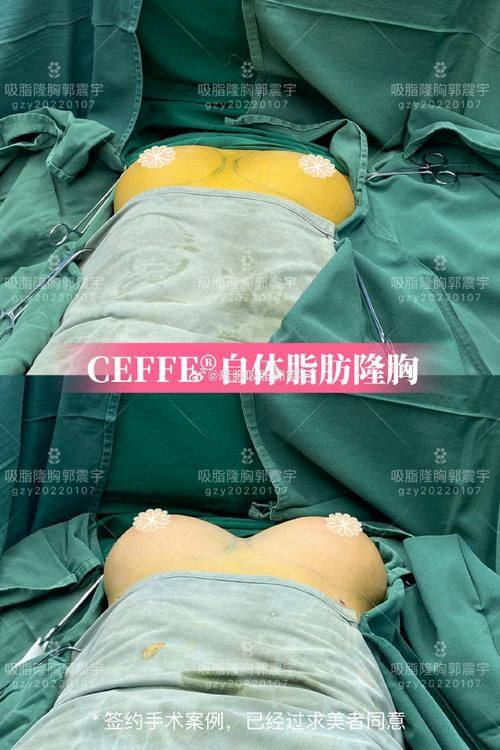 韩国SU i 整形外科真人口碑评价怎么样？