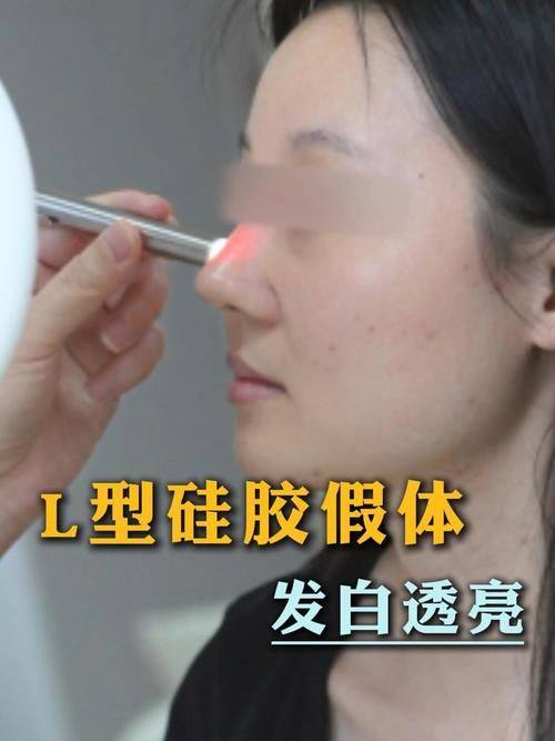 广州驻妍光医疗美容诊所真人口碑评价怎么样？