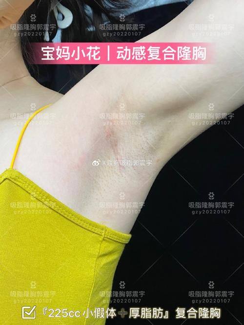 达州赋美轻美汇整形医院收费价格表/收费标准