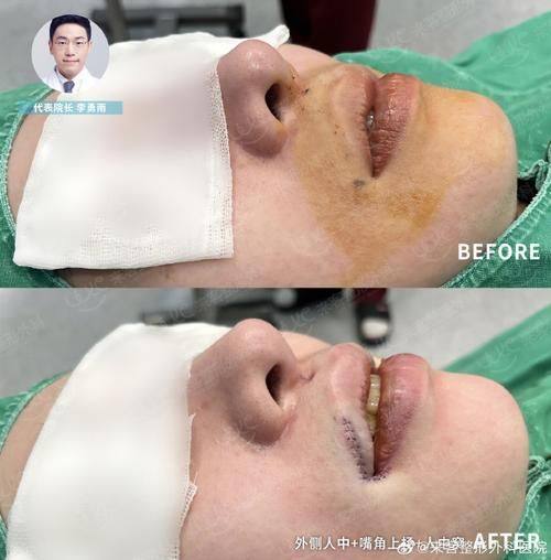 达州赋美轻美汇整形医院详细的预约挂号方式及流程