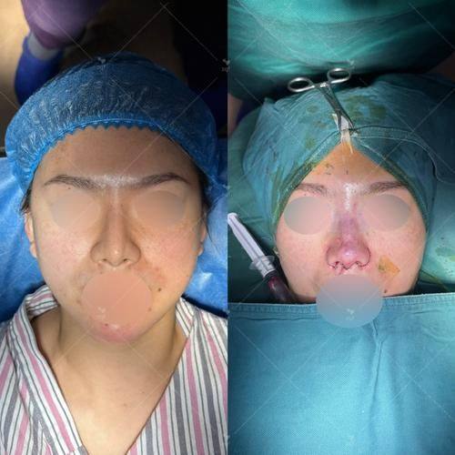 北京歆悦医疗美容医院特色项目及技术优势