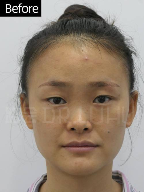 温州摩根艺术整形医疗美容医院真人口碑评价怎么样?