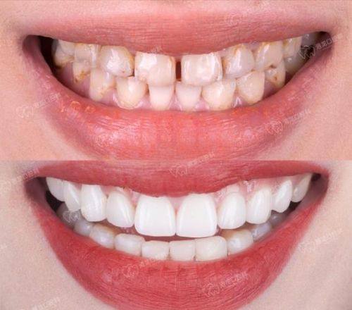 武汉清华阳光口腔门诊部有限公司鲁巷分公司详细的预约挂号方式及流程