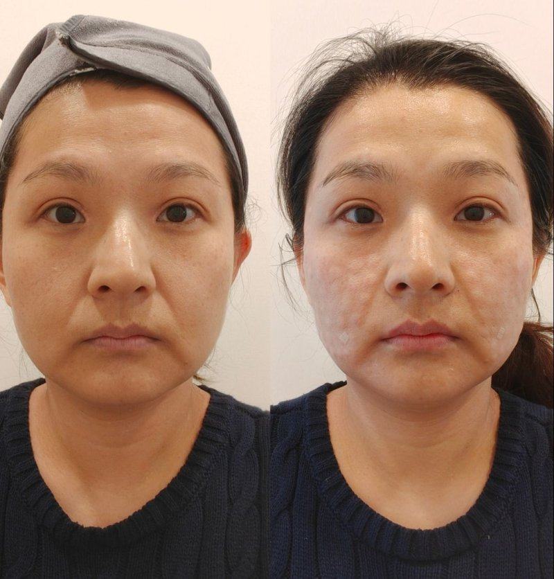 沈阳伊美尔医疗美容收费价格表/收费标准