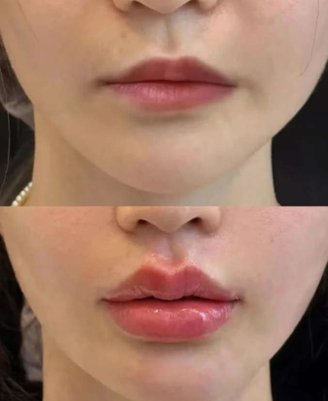 达州赋美轻美汇整形医院特色项目及技术优势