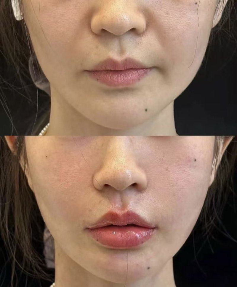 延吉清雅医疗美容诊所真人口碑评价怎么样？