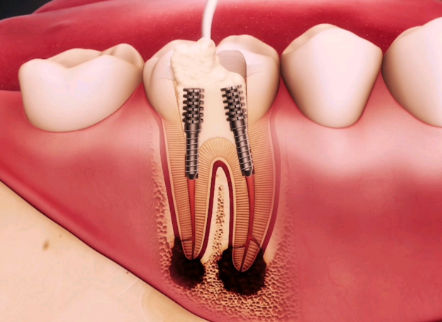 哈尔滨本善口腔门诊部详细的预约挂号方式及流程