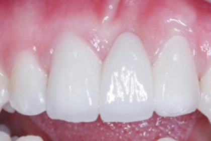 长沙芙蓉米子君口腔门诊部医生团队实力强大及骨干医生简介