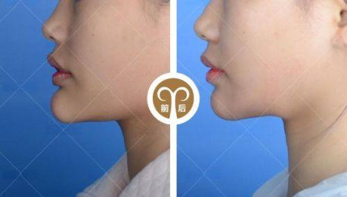 深圳韩美整形医院是正规医院吗？