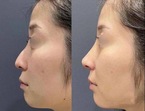 韩国三个心愿皮肤科明洞店收费价格表/收费标准