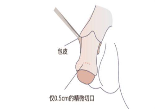温州壹美整形医院详细的预约挂号方式及流程