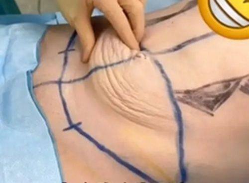 武汉卓妍医疗美容门诊部真人口碑评价怎么样？