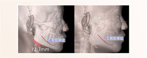 安徽省红十字会医院整形科真人口碑评价怎么样？
