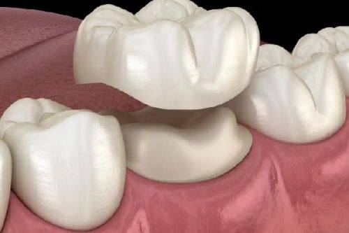 山东济宁汶上县孔德柱口腔真人口碑评价怎么样？