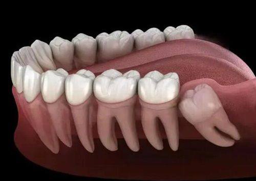 山东济宁汶上县孔德柱口腔特色项目及技术优势