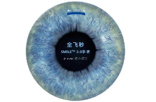 四川天府新区人民医院眼科真人口碑评价怎么样？