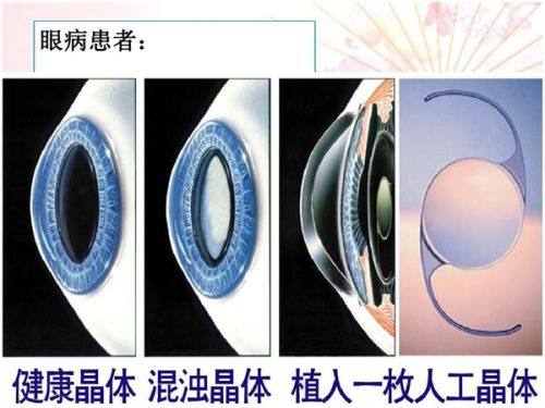 深圳韩美整形医院真人口碑评价怎么样？