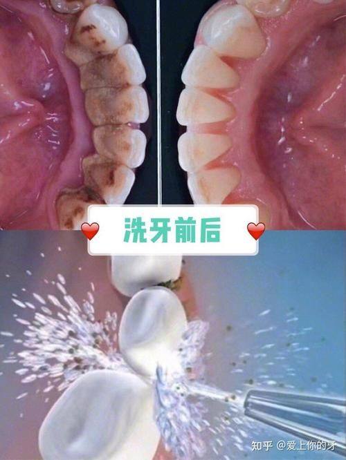 深圳皓尔笑口美口腔诊所收费价格表/收费标准