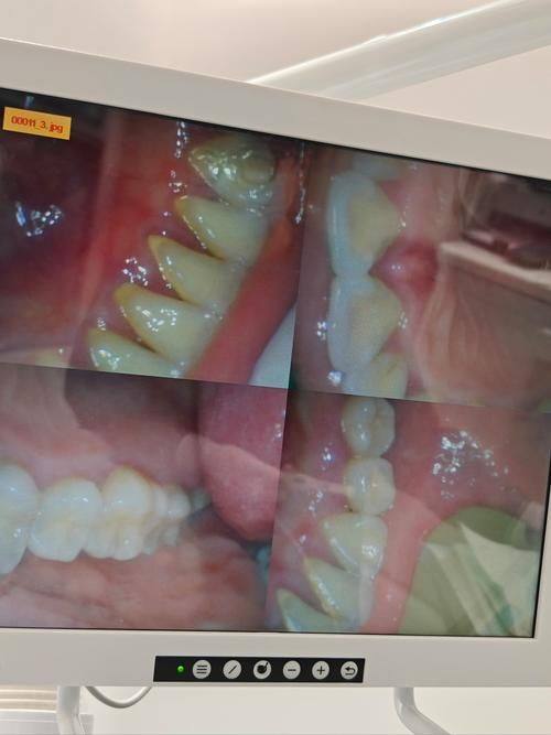 深圳皓尔笑口美口腔诊所真人口碑评价怎么样？