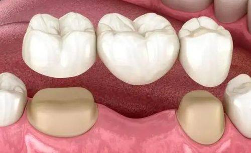 深圳皓尔笑口美口腔诊所特色项目及技术优势