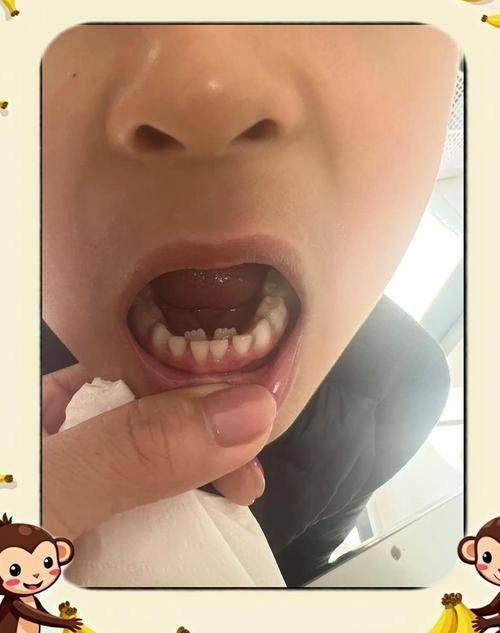 泰兴永丰口腔详细的预约挂号方式及流程