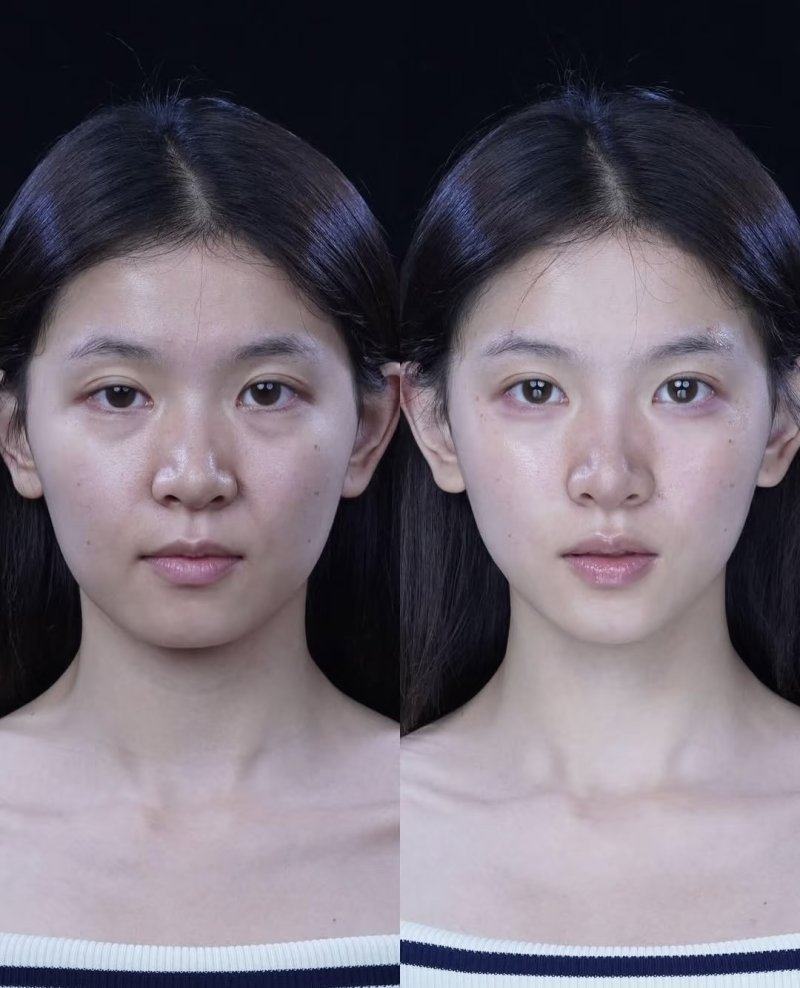 深圳韩美整形医院地址电话营业时间