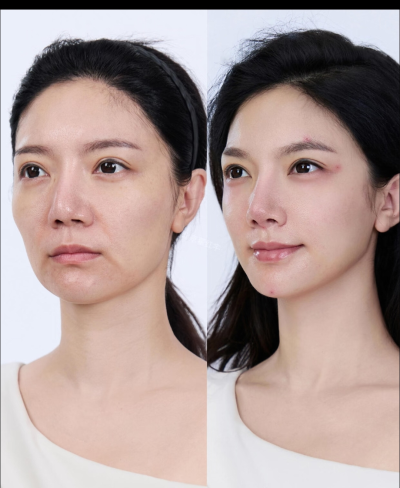 荆门京山姚善平医疗美容诊所是正规医院吗？