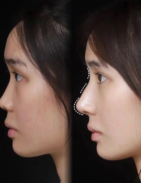 荆门京山姚善平医疗美容诊所收费价格表/收费标准