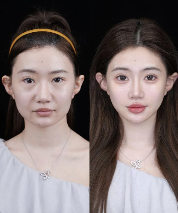 佛山悦琳坊整形医院收费价格表/收费标准