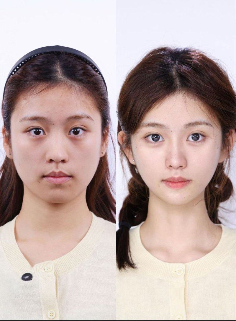 韩国三个心愿皮肤科明洞店特色项目及技术优势