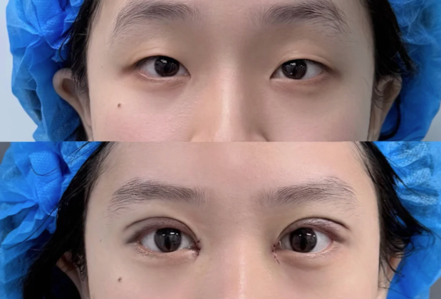 温州壹美整形医院特色项目及技术优势