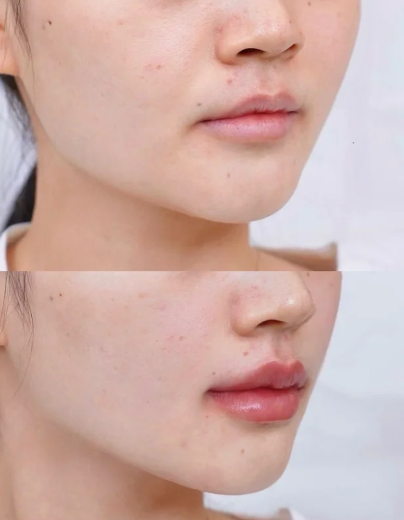 佛山悦琳坊整形医院特色项目及技术优势