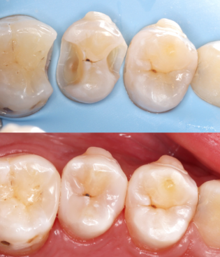 泰兴永丰口腔特色项目及技术优势